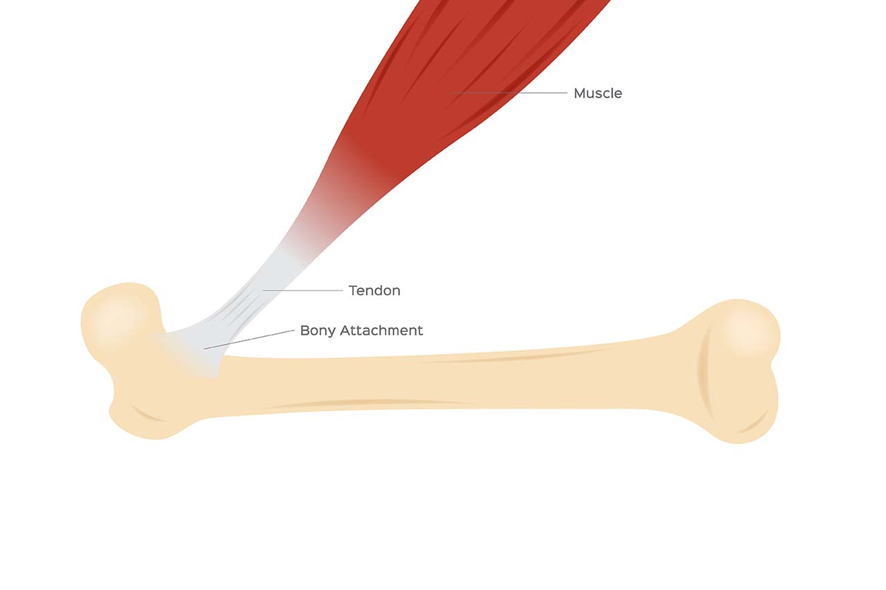 Medical illustration of a tendon, a type of fibrous connective tissue that connects muscles to bones, enabling movement and providing structural support.